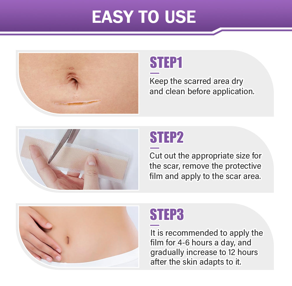 ✅Official Store |Ourlyard® Hyaluronic Acid Nano Microneedle Repair Tape☑️(Treatment of old and new scars, reduction of surgical scars, stretch marks, keloids, acne, burns, warts, dermatomes and varicose veins)✅