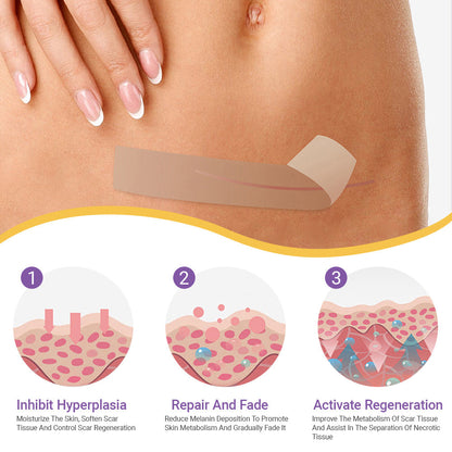 ✅Official Store |Ourlyard® Hyaluronic Acid Nano Microneedle Repair Tape☑️(Treatment of old and new scars, reduction of surgical scars, stretch marks, keloids, acne, burns, warts, dermatomes and varicose veins)✅