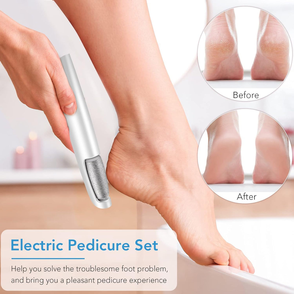 Remifa® Rechargeable Electric Callus Remover - Made In UK