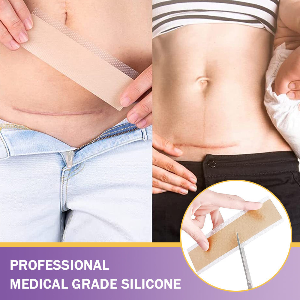 ✅Official Store |Ourlyard® Hyaluronic Acid Nano Microneedle Repair Tape☑️(Treatment of old and new scars, reduction of surgical scars, stretch marks, keloids, acne, burns, warts, dermatomes and varicose veins)✅